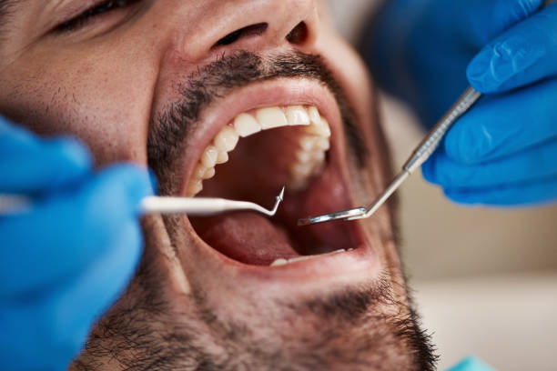 Best Emergency Dental Services for Seniors in Glenmont, MD